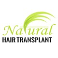 Hair transplant service